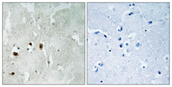 Anti-KAT5 / Tip60 (phospho S90) antibody(AB111588)