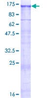 Recombinant Human KIAA0319L protein(AB164162)