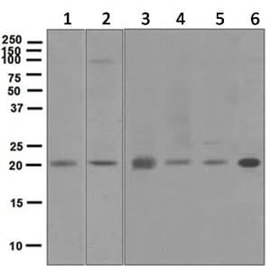 Dctn3 Antibody Epr5097 Ab124674  Western Blot Img30190
