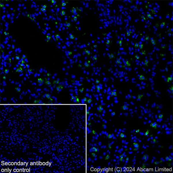 Anti-Prosurfactant Protein C antibody [RM1264](AB322443)