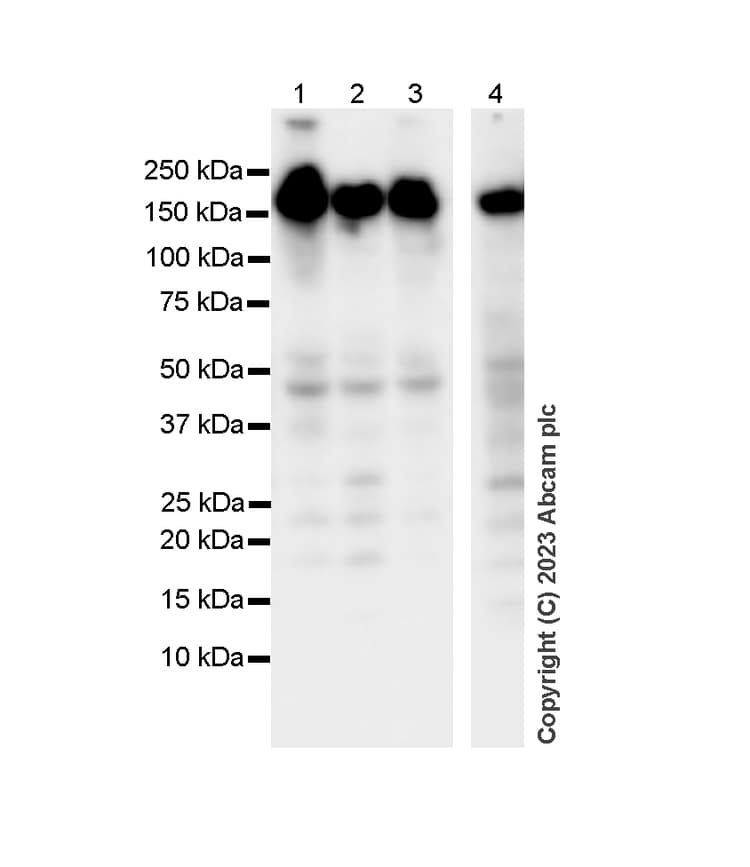 Anti-SF3B1 antibody [EPR11986](AB172634)