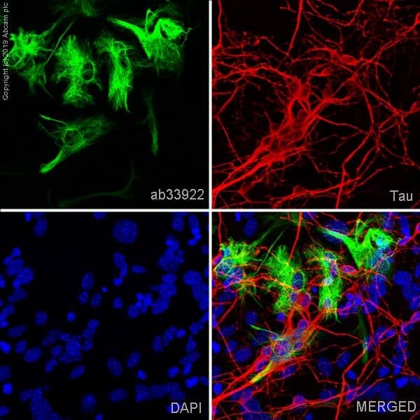 Anti-GFAP antibody [EP672Y](AB33922)
