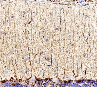 Anti-Glutamine Synthetase antibody(AB73593)