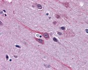 Gbx2 Antibody Ab109726  Immunohistochemistry Formalin Pfa Fixed Paraffin Embedded Sections Img128915