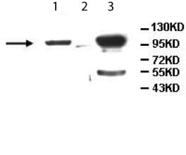 Aldh1l2 Antibody Ab113496  Western Blot Img7873