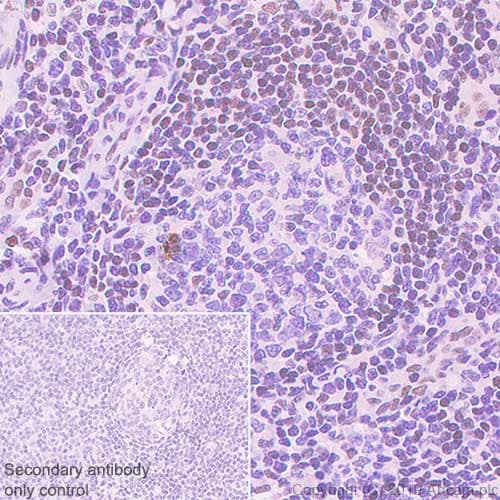 Anti-FOXP1 antibody [SP133] - C-terminal(AB227649)