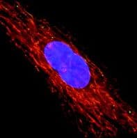 Anti-VDAC1/Porin + VDAC3 antibody [20B12AF2](AB14734)