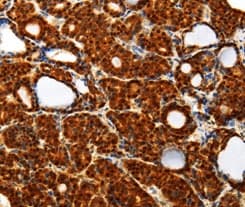 Thioredoxin Trx Antibody Ab185329  Immunohistochemistry Formalin Pfa Fixed Paraffin Embedded Sections Img107733