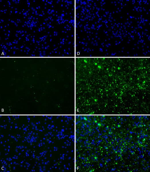 Recombinant Human Alpha-synuclein protein aggregate (Active)(AB218819)