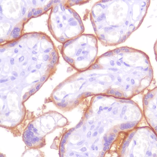 Pd L1 Antibody Sp142 C Terminal Ab228462  Immunohistochemistry Formalin Pfa Fixed Paraffin Embedded Sections Img136914