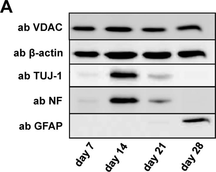 68kda Neurofilament Nf L Antibody Da2 Ab7255  Western Blot Img442466