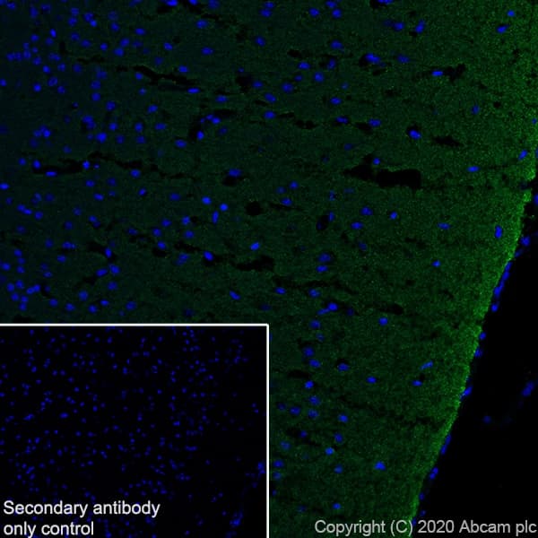Synaptic Marker (Synaptophysin, Synapsin1, PSD95, VAMP2) Antibody Sampler Panel - Human, Mouse(AB263463)