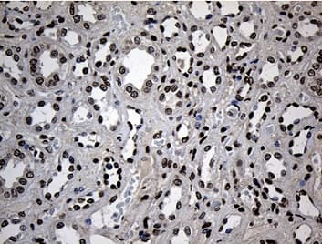 Znf558 Antibody Oti2c4 Ab236428  Immunohistochemistry Formalin Pfa Fixed Paraffin Embedded Sections Img131650