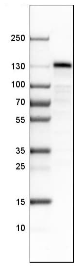 Ston2 Antibody Ab121165  Western Blot Img22430