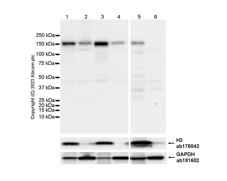 Anti-SF3B1 antibody [EPR11986](AB172634)