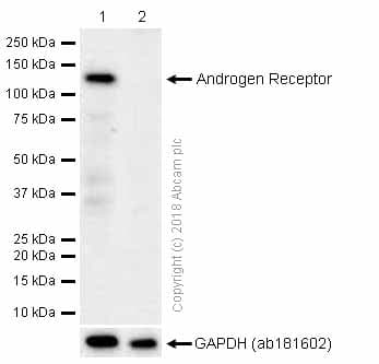 Anti-Androgen Receptor antibody [EP670Y](AB52615)