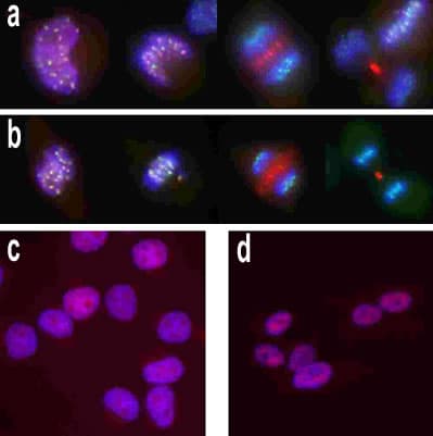 Anti-Aurora B antibody(AB2254)