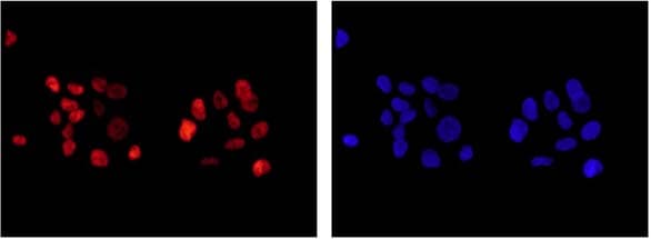 Anti-ARID1A antibody [EPR13501](AB182560)