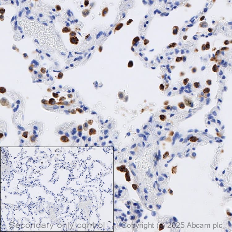 Anti-Prosurfactant Protein C antibody(ab90716)