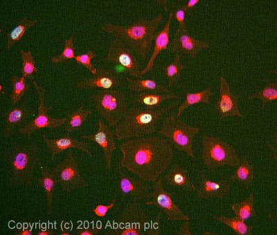 Anti-DDB2 antibody [2246C4a](AB51017)