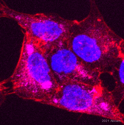 Anti-Mucin 5AC antibody [45M1](ab3649)