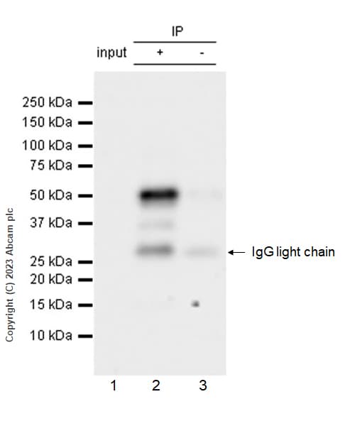 Mouse IgG1, kappa monoclonal [MOPC-21] - isotype control(AB18443)