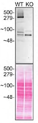 Anti-Huntingtin antibody [EPR5526](AB109115)