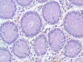 Anti-Nestin antibody [SP103](AB105389)