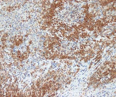 Anti-Sumo 2 + Sumo 3 antibody(AB3742)