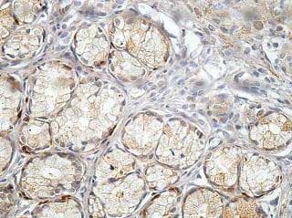 Bckdhb Antibody Ab201225  Immunohistochemistry Formalin Pfa Fixed Paraffin Embedded Sections Img136080