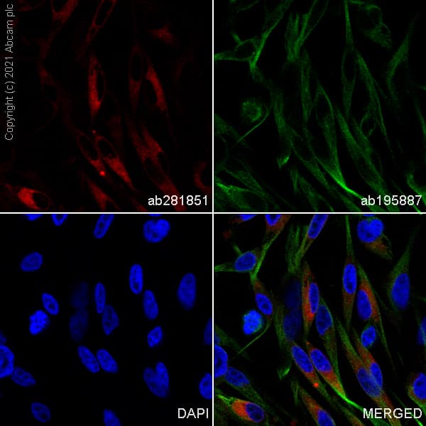 Alexa Fluor 647 Melana Antibody Ep1422y Ab281851  Immunocytochemistry Immunofluorescence Img14256