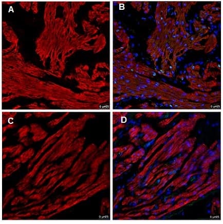 Anti-Cardiac Troponin T antibody [1C11](AB8295)