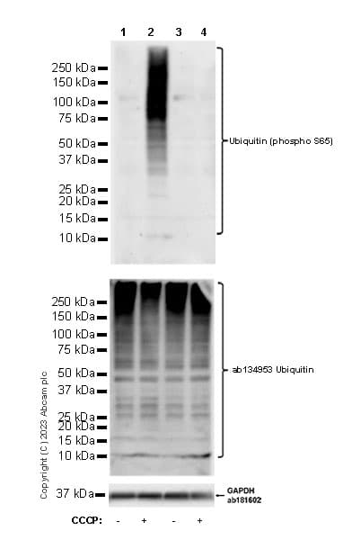 Anti-Ubiquitin (phospho S65) antibody [30H3/30K1](AB309155)