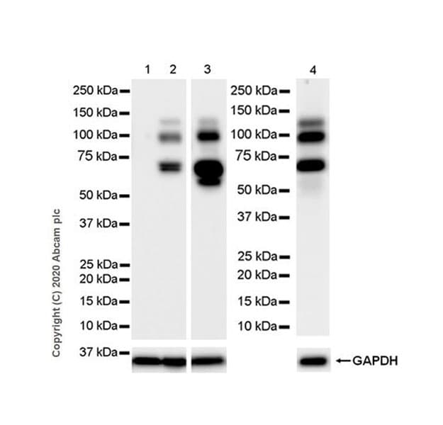 Anti-ADAMTS1 antibody [EPR23324-45](AB276133)
