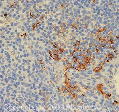 Anti-ENPP2/ATX antibody [1F8](AB77104)