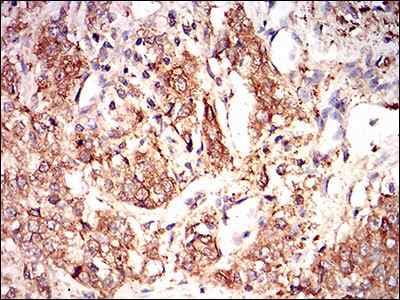 Eif2a Antibody 3a7b11 Ab181467  Immunohistochemistry Formalin Pfa Fixed Paraffin Embedded Sections Img133196
