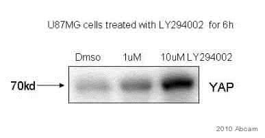 Anti-YAP1 antibody [EP1674Y](AB52771)