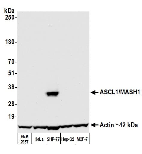 Anti-ASCL1/MASH1 antibody [BLR164J] - BSA free(AB314100)