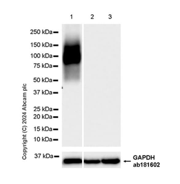 Fgfr2iiib Fgfr2b Antibody Epr28355 27 Ab318274  Western Blot Img433051