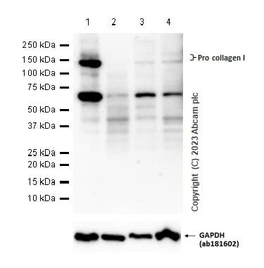 Anti-Collagen I antibody [EPR24331-53](AB270993)