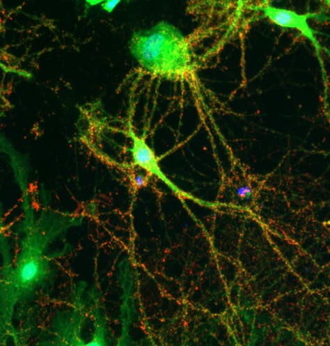 Synaptophysin Antibody Synaptic Marker Ab32594  Immunocytochemistry Immunofluorescence Img101279
