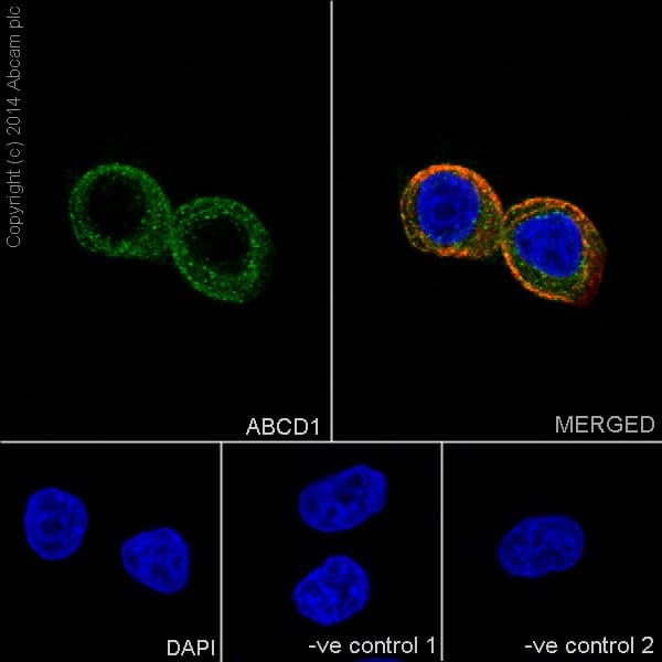 Anti-ABCD1/ALD antibody [EPR15929](AB197013)
