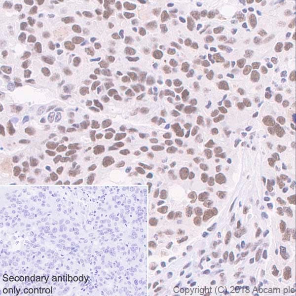 Anti-Cdk9 antibody [EPR3119Y](AB76320)