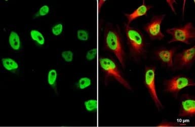Loxl2 Antibody Ab96233  Immunocytochemistry Immunofluorescence Img443661