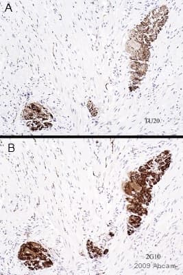 Anti-beta III Tubulin antibody [TU-20] - Neuronal Marker(ab7751)