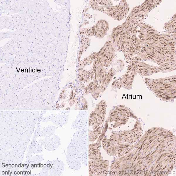 Bnp Antibody Epr22339 65 Bsa And Azide Free Ab243857  Immunohistochemistry Formalin Pfa Fixed Paraffin Embedded Sections Img83266
