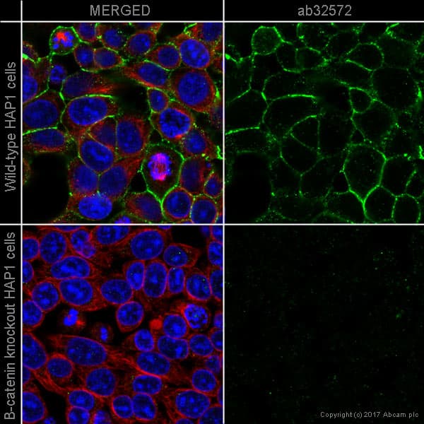 Anti-beta Catenin antibody [E247] - ChIP Grade(AB32572)