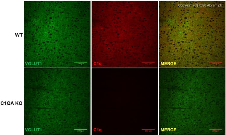 Anti-C1q antibody [4.8](AB182451)