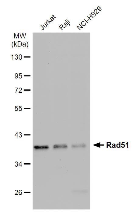 Anti-Rad51 antibody [14B4](AB213)