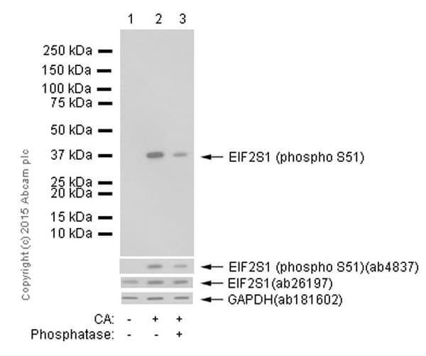 Anti-EIF2S1 (phospho S51) antibody [E90](AB32157)
